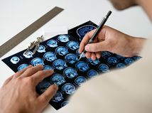 Udržte svoj mozog fit, napriek pribúdajúcim...