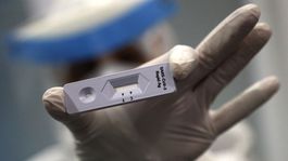 Eurokomisia odporučila používanie antigénových testov na COVID-19