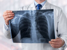 doktor, snímka, pľúca, röntgen, RTG
