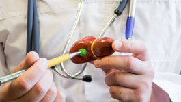 Gastroenterológ Kužela: Čo s podráždeným žlčníkom počas sviatkov?