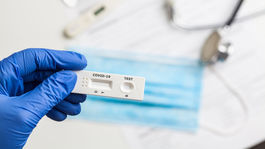 Antigén, PCR, test na protilátky. Ktorý je kedy lepší?