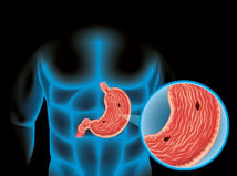 Gastroskopia na vlastnej koži. Dá sa...