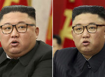 North Korea Thinner Kim