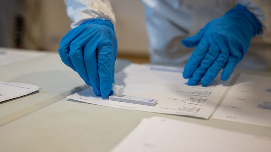 Nepribudlo žiadne úmrtie na covid, pozitivita PCR testovania dosiahla tri percentá