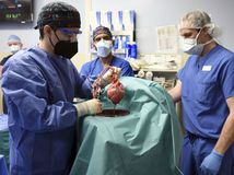Pig Heart Transplant