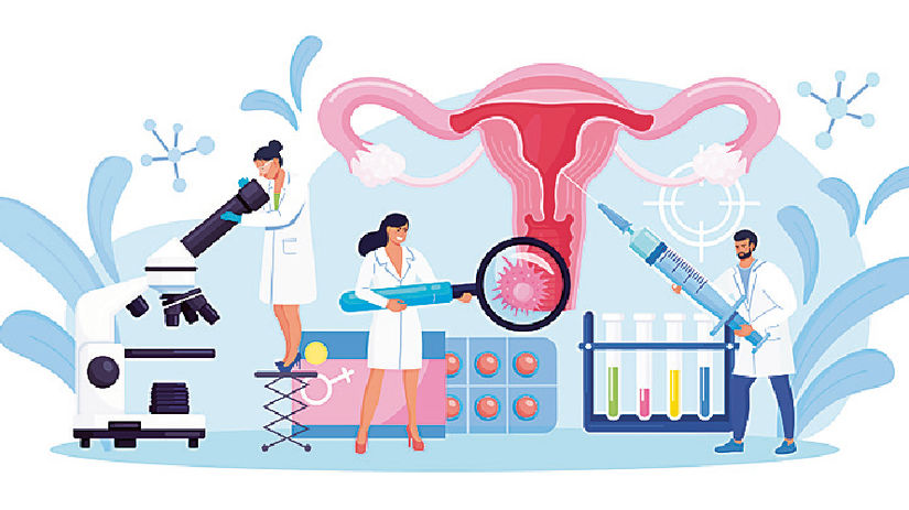 maternica, krčok maternice, HPV, rakovina krčka...