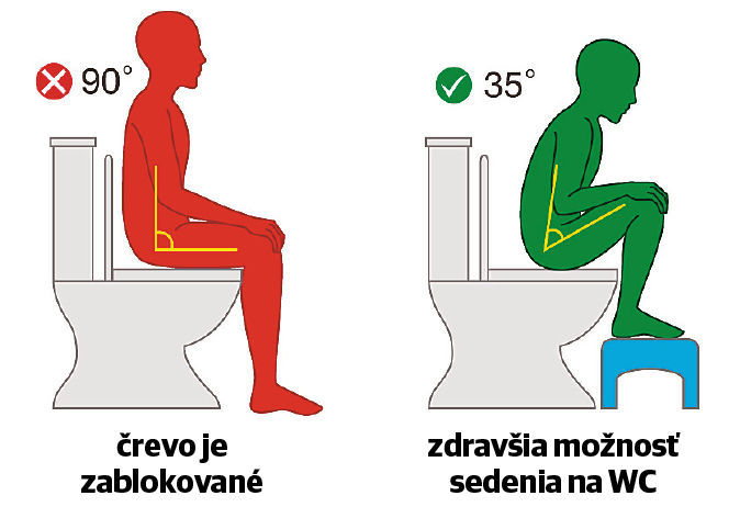 Ilustračné foto.
