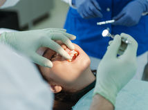 zuby, zubár, čeľustný ortopéd, strojček, zubný strojček