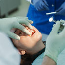 dinti, stomatolog, ortoped maxilar, aparat dentar, aparat dentar