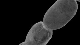 Veda baktéria najväčšia