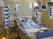 dieťa, pacient, kardiocentrum