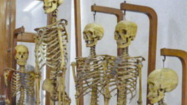 anatomické múzeum, Bangkok, kostra, kostry