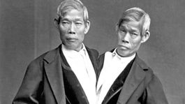Chang a Eng, siamské dvojčatá,  bratia, Thajsko