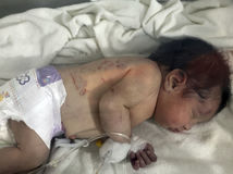 Sýria Turecko zemetrasenie obete novorodenec záchrana