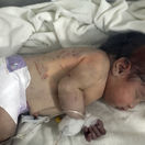 Sýria Turecko zemetrasenie obete novorodenec záchrana