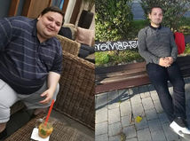 obezita, obézny pacient, Igor Bartho, extrémna obezita, pred a po