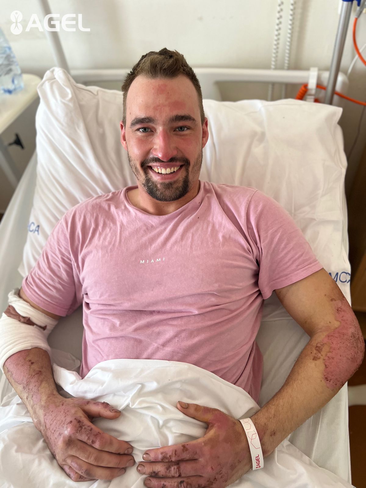 Lukáš (27), jeden z popálených baníkov.