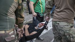 Záchranári pomáhajú raneným po ruskom raketovom...