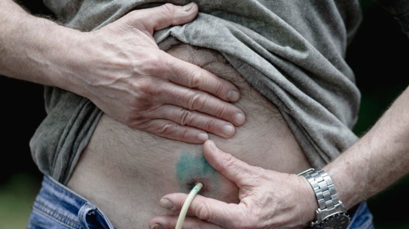 Lekári Baryšnikovovi diagnostikovali nádor s...