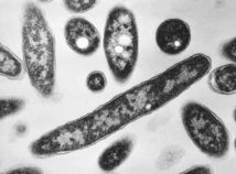 Legionárska choroba / Legionella pneumophila / Legionelóza /