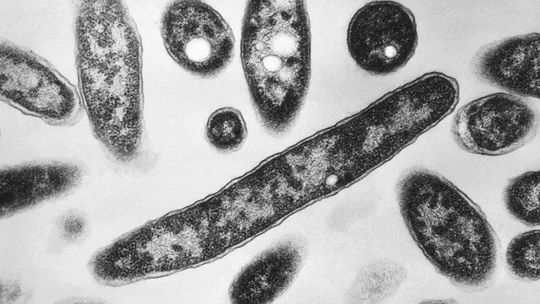 V hotelovej vírivke v Demänovskej Doline potvrdili prítomnosť baktérie Legionella
