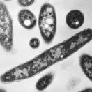 Legionárska choroba / Legionella pneumophila / Legionelóza /