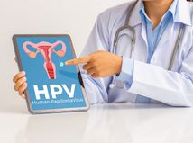 HPV titulna, pr, nepouzivat 