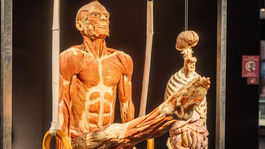 výstava Body Worlds, plastinácia