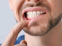 Revolúcia pre zdravé ďasná je tu. Zabudnite...