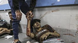 Palestínčania / Ranení / al-Shifa / Gaza /