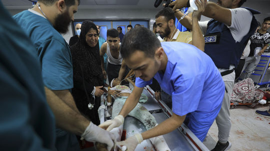 Svet katastrofálne zlyhal, trpia nevinní. Lekári v Gaze operujú a amputujú bez anestézie