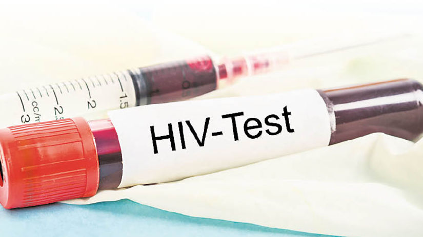 HIV, vírus, AIDS, skúmavka, krv, test