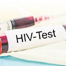 HIV, vírus, AIDS, skúmavka, krv, test