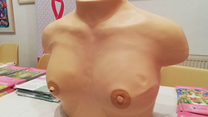 model, vonkajšie príznaky, rakovina prsníka