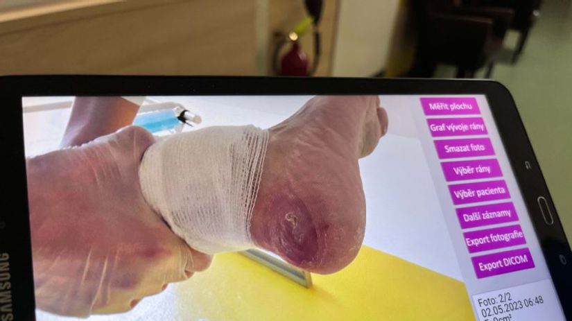 Rany a dekubity si pravidelne fotografuje.