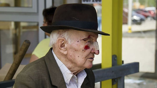 Na snímke starý muž čaká na ošetrenie po ruskom...