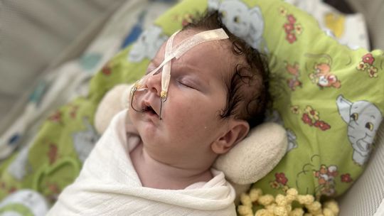 Esterka po zavedení Tubingenskej palatinálnej...