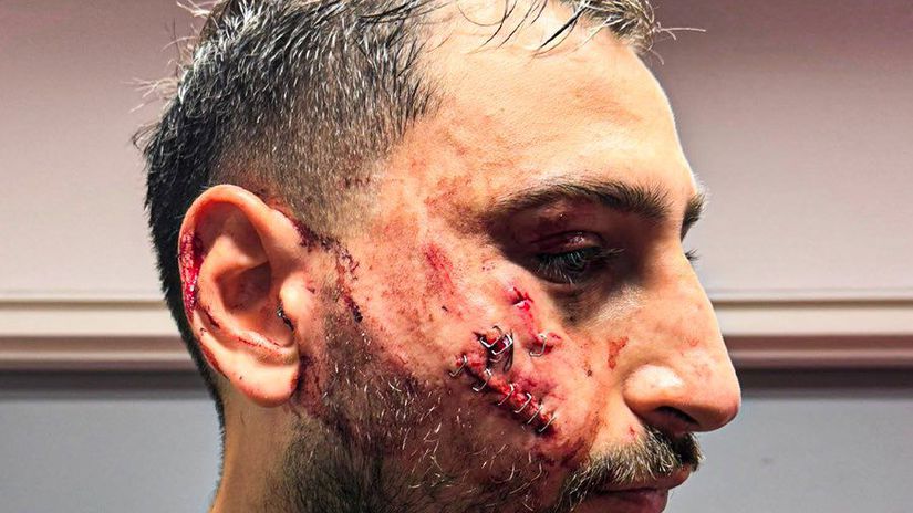 Gianluigi Donnarumma