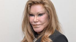 Vo veku 84 rokov zomrela Jocelyn Wildenstein.