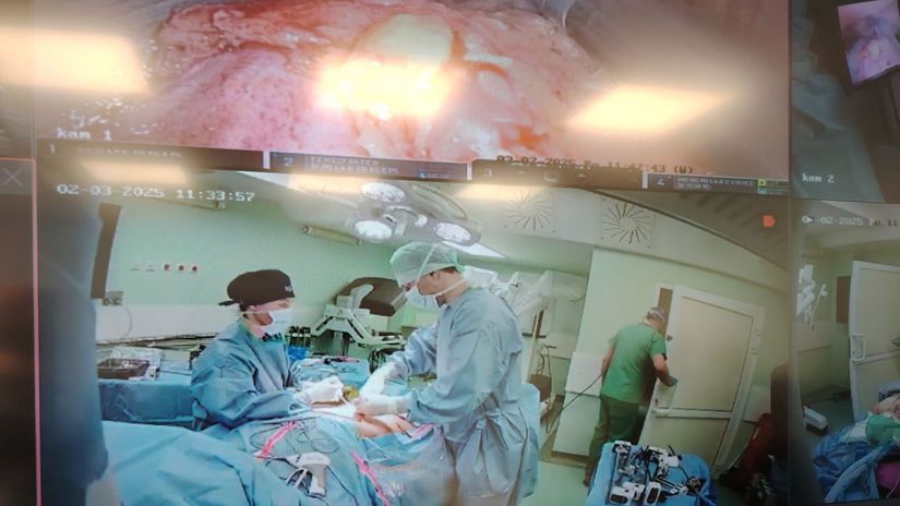 Roboticky asistovanú operáciu môžu v...