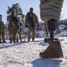 vojna na Ukrajine, amputácia