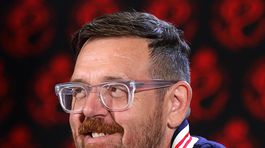 Nick Frost