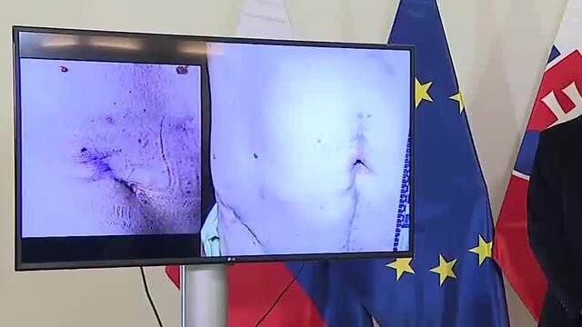 Snímky z ošetrenia premiérovho brucha po streľbe.