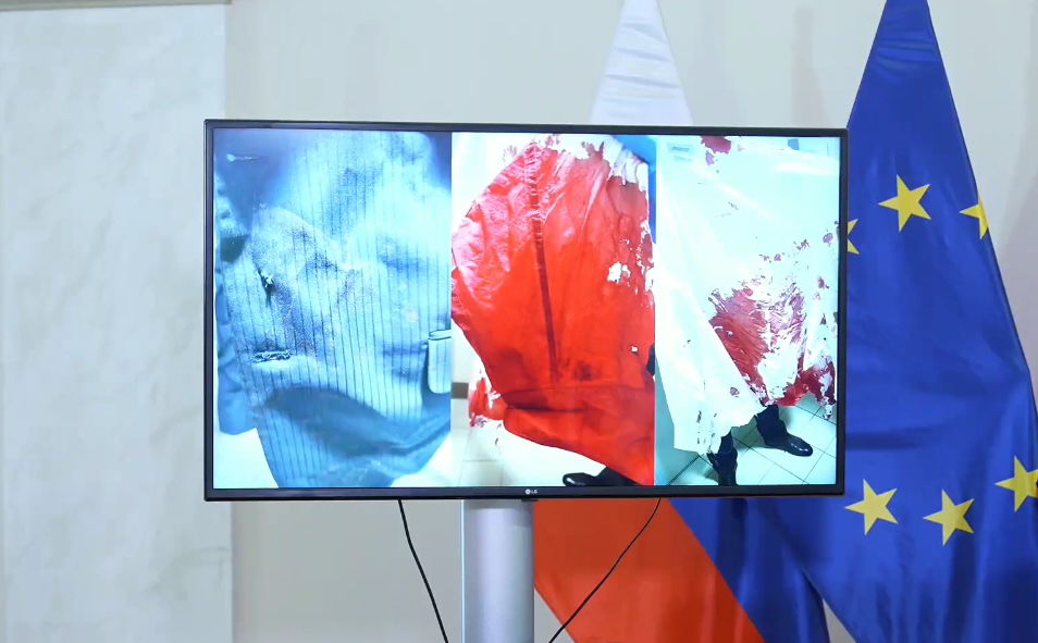 Krvavá košeľa Roberta Fica po atentáte