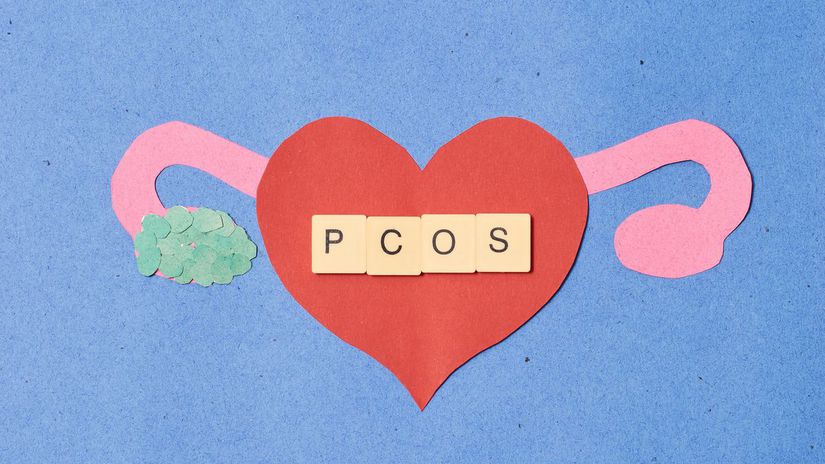 PCOS, neplodnosť, maternica
