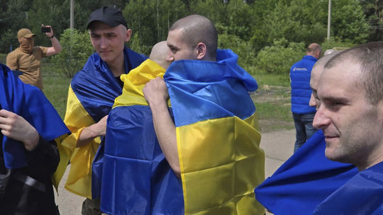 Sadizmus ruských väzníc: šokovaný lekár zverejnil fotku vojaka, ktorému Rusi v zajatí vypálili do tela odkaz 