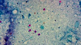 Kryptosporidie