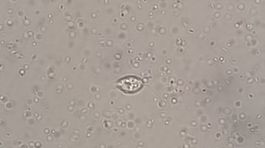Naegleria fowleri - dvojbicikate stadium