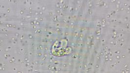 Naegleria fowleri - trofozoit
