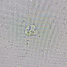 Naegleria fowleri - trofozoit